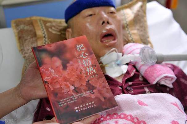 渐冻症早期的8个征兆李宇春 渐冻症最开始的状态是什么样