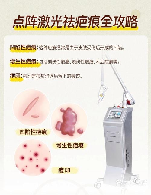 激光去疤收费怎么样 激光祛疤如何收费