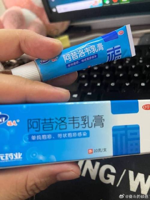 嘴巴上火起泡擦什么药 嘴巴上火起泡擦什么药膏好得快