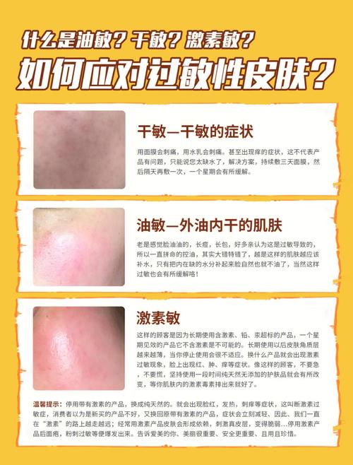 脸过敏发红痒怎么办 脸反复过敏的7大原因