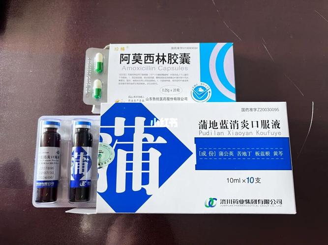 扁桃体发炎吃什么药 扁桃体炎四大特效药