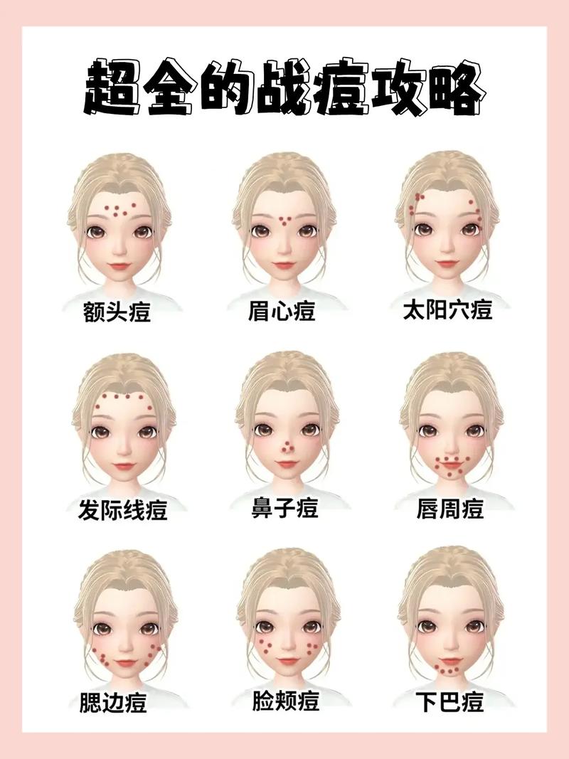 脸上长痘痘怎么调理 脸上痘痘挤出来白色一坨的是什么