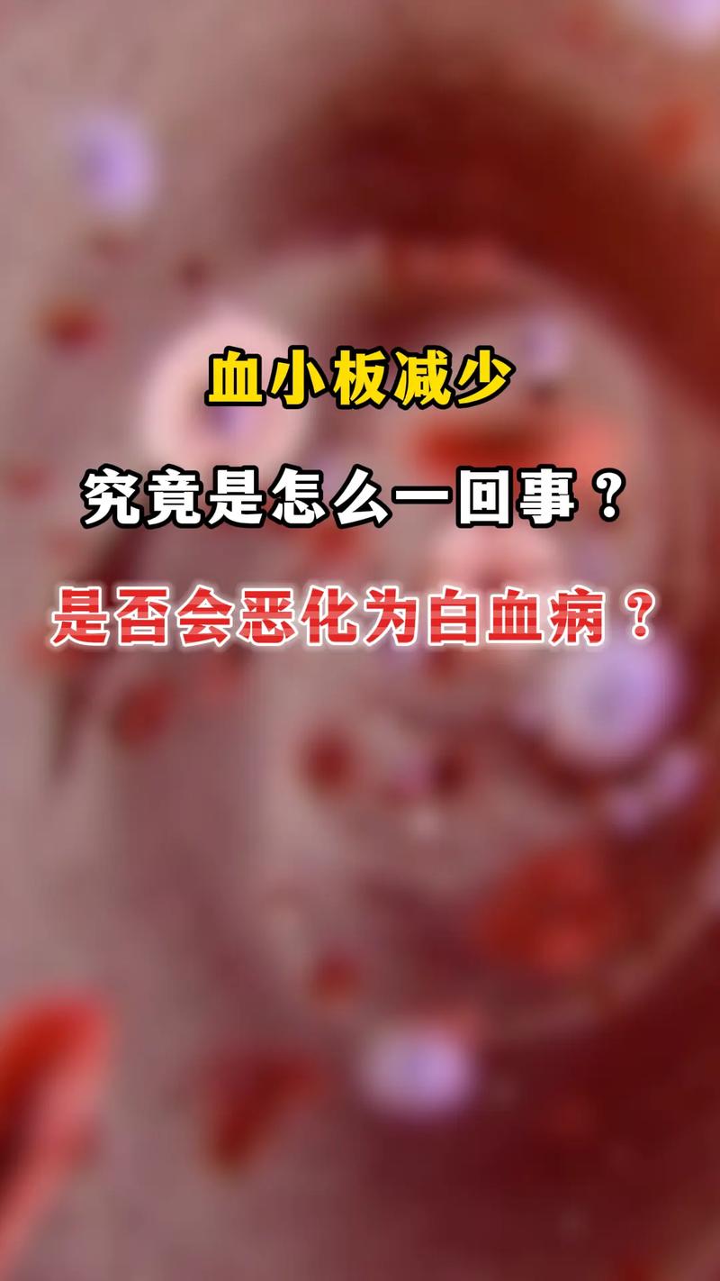 白血病是怎么引起的 血小板减少症治疗的最好方法