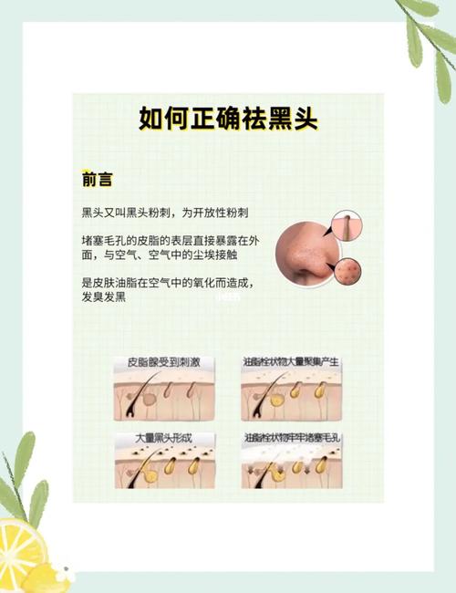 如何去黑头 怎样正确去除黑头