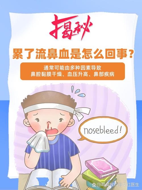 流鼻血是什么原因 无缘无故流鼻血是怎么回事