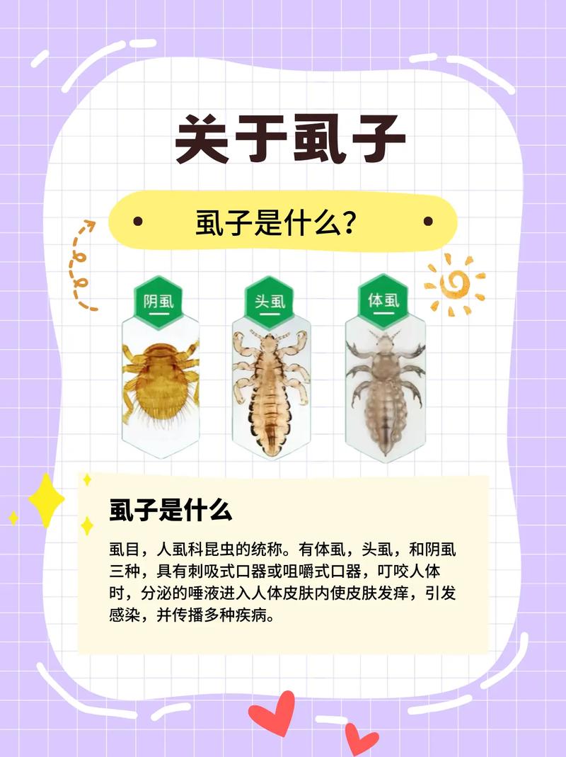 虱子是怎样滋生出来的 虱子是怎样滋生出来的？